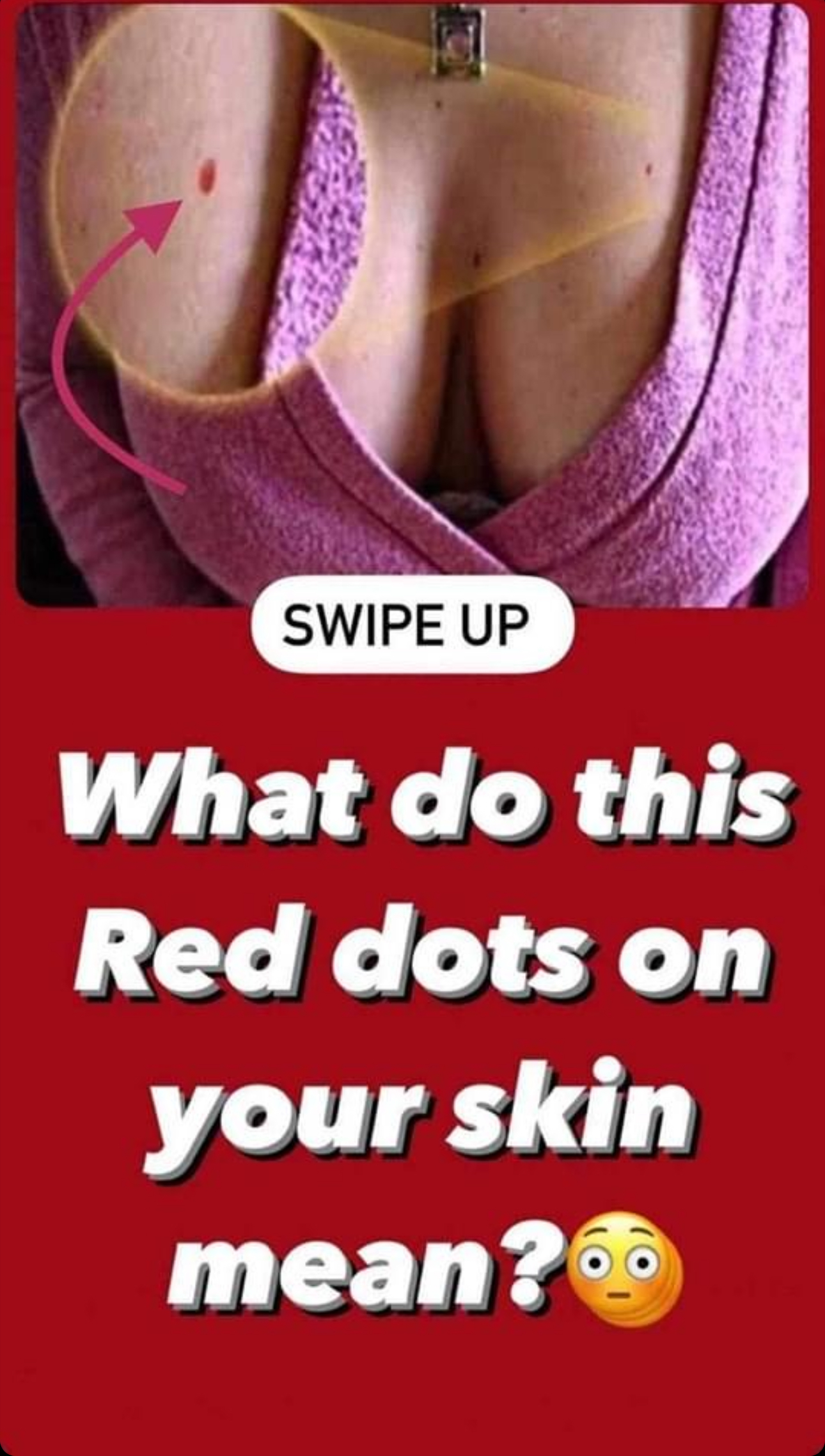 Should red spots on various part of your body worry you and what to do if you have them