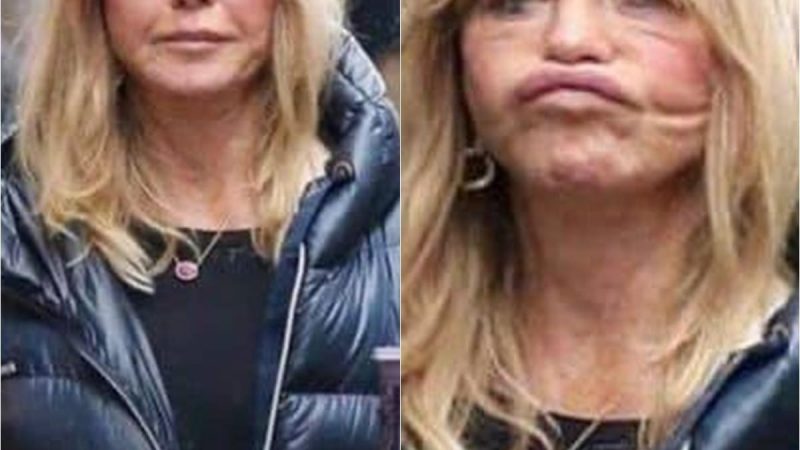 Unsuccessful Facelift Ruins 77-Year-Old Goldie Hawn’s Appearance Dramatically
