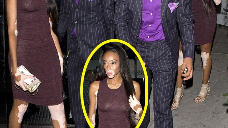 Nick Cannon, 34, plays the perfect gentleman as he treats rumoured model girlfriend with vitiligo skin condition Winnie Harlow, 21, to a romantic dinner date